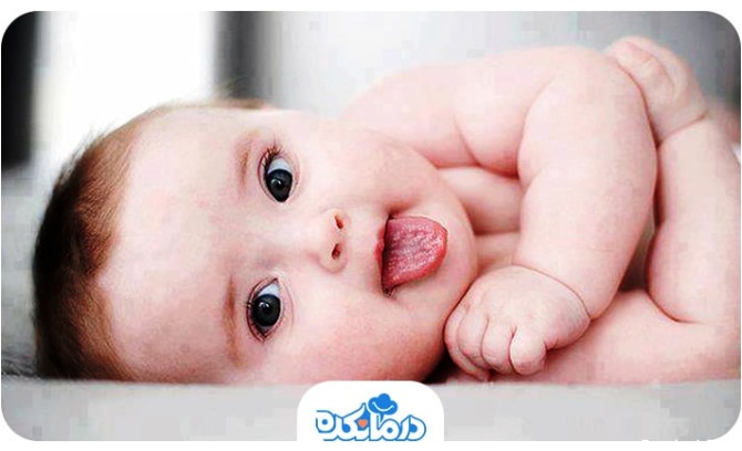 نوزاد کوچکی که در هفته‌ و ماه‌های اول زندگی به برفک دهان مبتلا شده است.