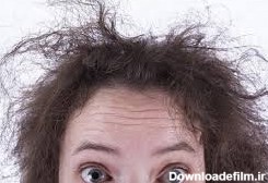 آخرین خبر | علت خشک و شکننده بودن موی سر