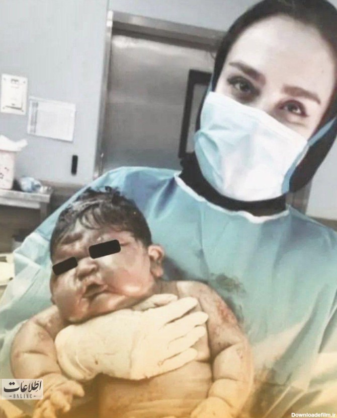 عکس| سنگین‌ترین نوزاد ایران که در مشهد به دنیا آمد!