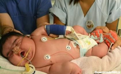 رکورد چاق‌ترین نوزادان دنیا (+عکس)