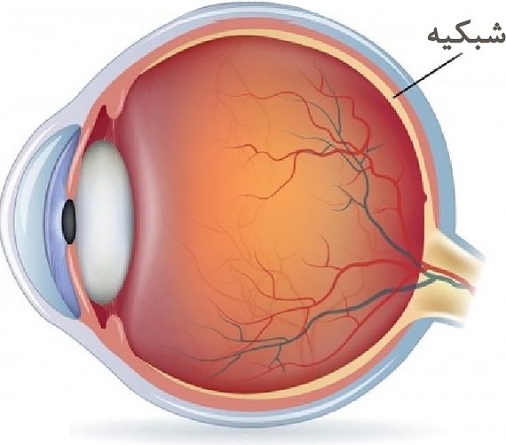 بیماری‌های شبکیه - مرکز چشم پزشکی سلامت غرب تهران