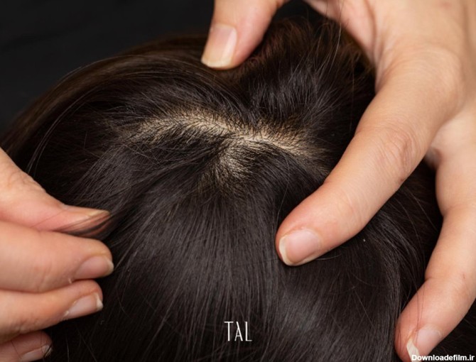 پیاز مو چیست و چگونگی تقویت پیاز مو | تال هیر