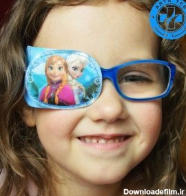 چشم بند عینک (پد عینک) را برای درمان تنبلی چشم کودکان استفاده کنیم ...