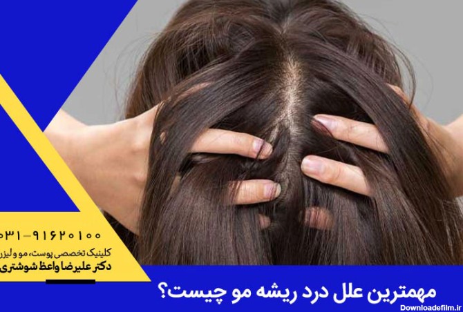 علت و درمان درد ریشه مو
