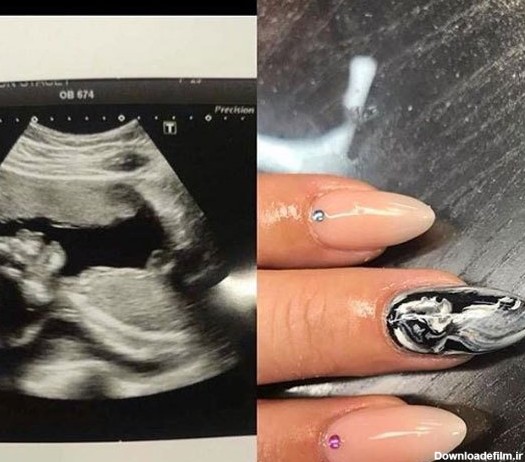 چاپ عکس «جنین» روی ناخن مادران ! + تصاویر