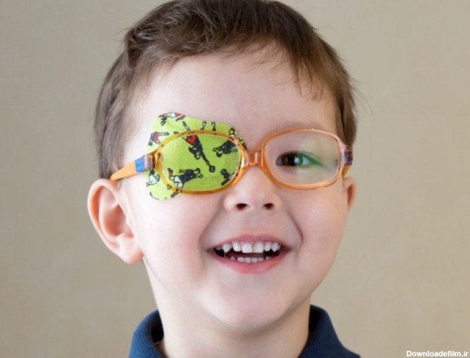 نشانه های تنبلی چشم کودکان و بررسی درمان های مختلف و تمرین های خانگی