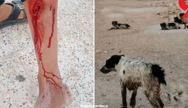 عکس حمله سگ وحشی به انسان