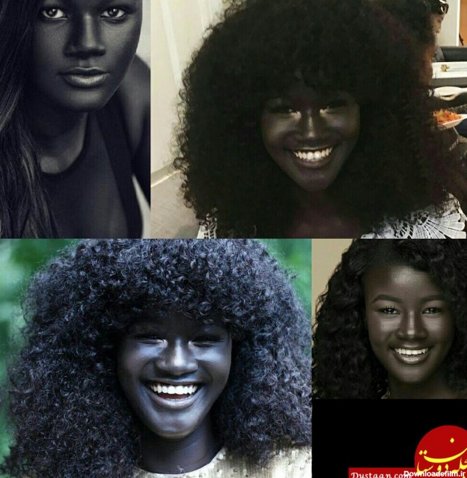 دختر زیبایی که سیاه ترین پوست جهان را دارد!