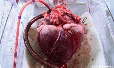 قلب انسان اینطوری می زند (عکس متحرک)