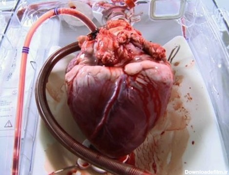 تلاش دانشمندان برای ساخت قلب مصنوعی اتمی/دوران باتری قلب به پایان ...