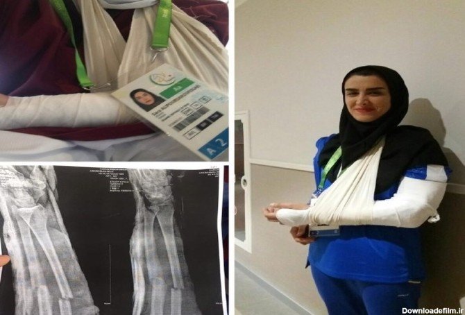 دست دختر کشتی گیر ایرانی در ترکمنستان شکست +عکس | پایگاه خبری جماران