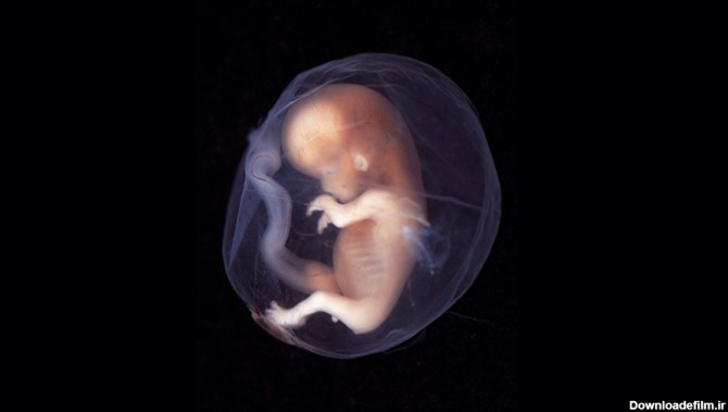 نگران بارداری بعد از سقط جنین نباشید | مجله نی نی سایت