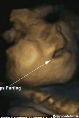 حرکت باور نکردنی جنین درون شکم مادر +تصاویر
