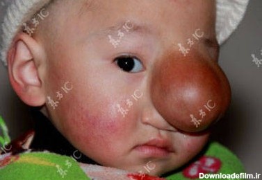 پسر بچه ای در چین که کپی پینوکیو است+ عکس | یک بچه در چین بخاطر ...