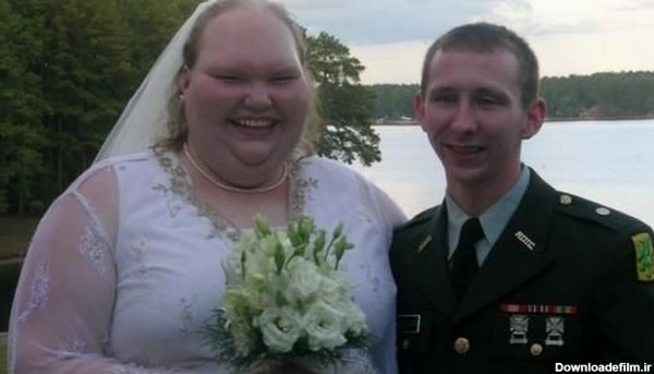 شوک زشت ترین عروس دنیا  که زیباترین زن شد + عکس قبل و بعد را ببینید