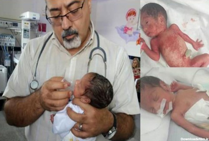 نوزاد پسر ۷۰۰ گرمی نارس پس از ۲ ماه مراقبت به آغوش مادر بازگشت