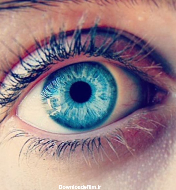 رنگ چشمها - چشم پزشکی نوآوران