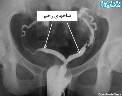 زمان مناسب برای عکس رنگی رحم