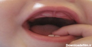10+ دندانپزشکی :: دهان نوزاد شما