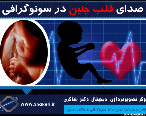 صدای قلب جنین در سونوگرافی