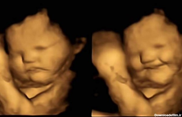 شگفت‌انگیزترین تصاویر از نوزاد در شکم مادر - بهار نیوز