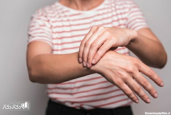 دررفتگی مچ دست ؛ علت، علائم و درمان جابه‌جایی مچ دست