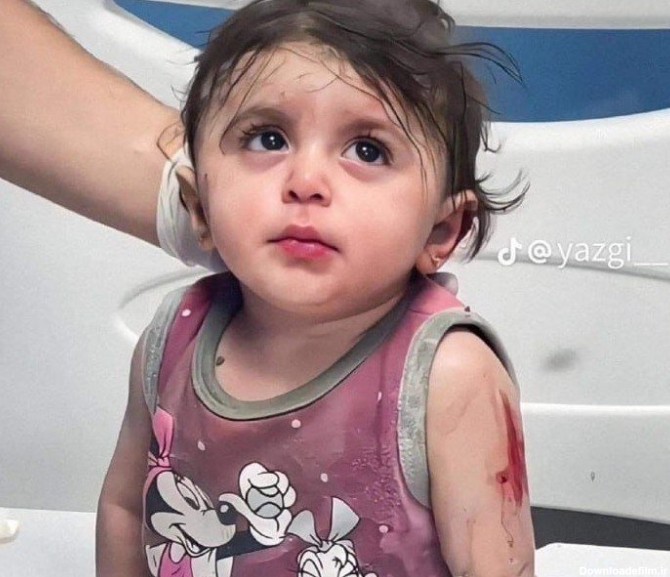 عکس تازه از دختر غزه ای که ترسیده بود - همشهری آنلاین