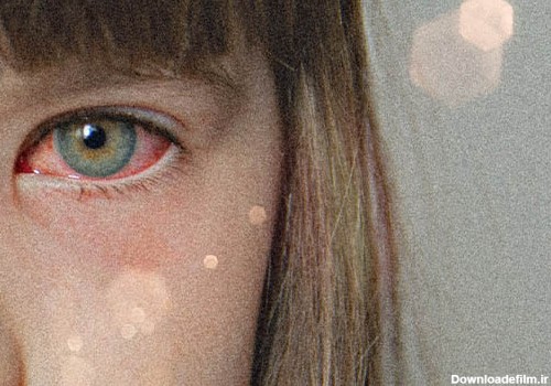 عارضه قرمز شدن چشم در کودکان می‌تواند به دلایل مشابه در بزرگسالان حادث شود.