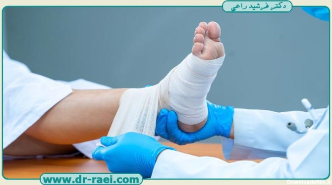 پارگی رباط در مچ پا | درمان آن | بهترین متخصص ارتوپد در تهران