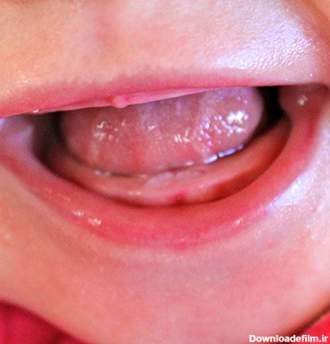 درد دندان درآوردن کودکان - دکتر ماندانا حجازی متخصص ...