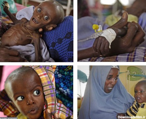تصاویر: این نوزاد سومالیایی را به یاد دارید؟ | سایت انتخاب