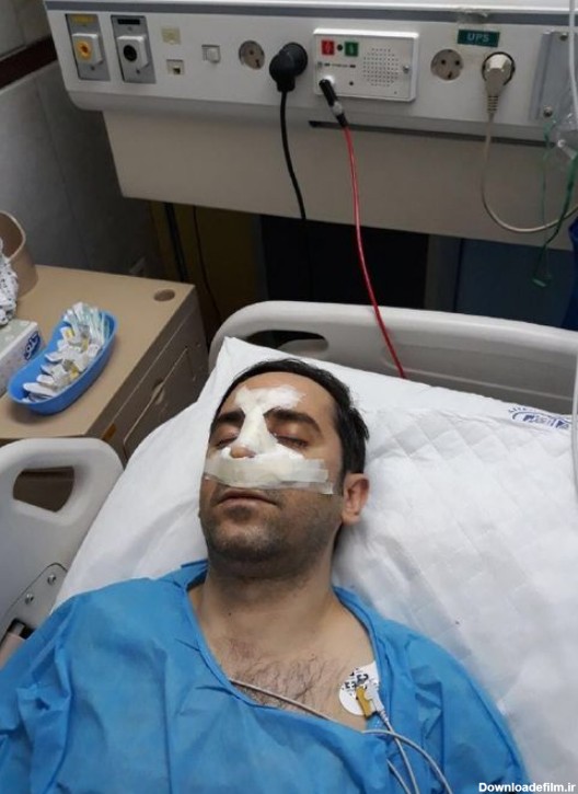 علی خطیر روی تخت بیمارستان +عکس