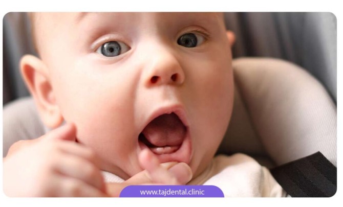 علائم و نشانه های دندان درآوردن نوزاد + کاهش درد دندان ...