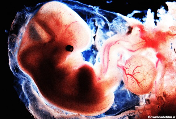 پرسش مهمی که خانم‌ها درباره سقط جنین می‌پرسند | مجله نی نی سایت