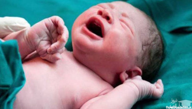 عکس) تصویر لحظه به دنیا آمدن یک نوزاد جهانی شد