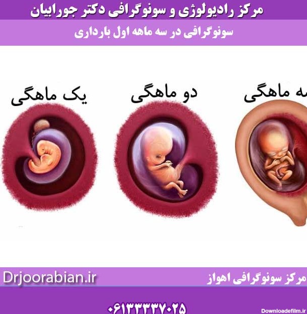 سونوگرافی در 3 ماهه اول بارداری | تعیین سن حاملگی - دکتر مرتضی ...