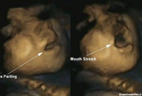 تصاویر سه‌بعدی خارق‌العاده از جنین آماده تولد