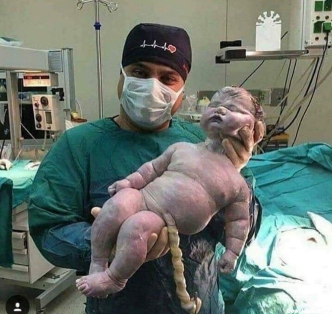 فرارو | (تصویر) سنگین‌ترین نوزادان جهان در بدو تولد
