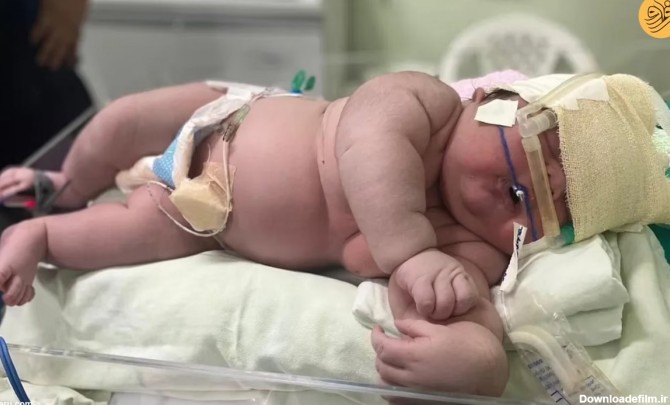فرارو | (عکس) تولد یک نوزاد ۷ کیلویی!