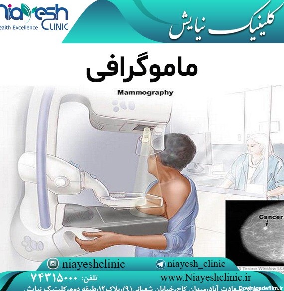 ماموگرافی | سرطان سینه | سرطان پستان | علائم سرطان سینه | کلینیک نیایش