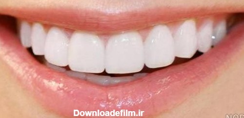عکس سفید دندان