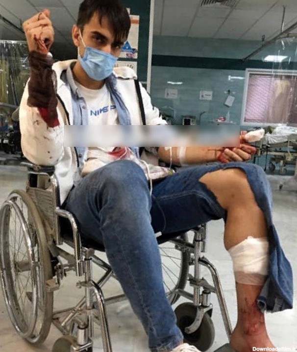فوتبالیست ایرانی چاقو خورد /عکس - بهار نیوز
