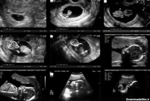سونوگرافی دوران بارداری | کلینیک سونوگرافی دکتر کاوه شکری