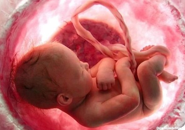 پره اکلامپسی در بارداری موجب کُندشدن روند رشد جنین می شود ...