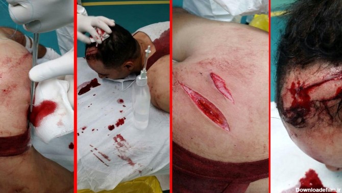 حمله خونین به جوان خرمشهری +عکس | 2 جوان چاقو به دست کارمند - آمد خبر