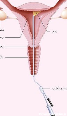 مراکز عکس رنگی رحم در کرج