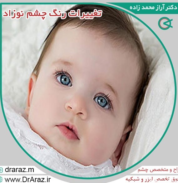 تغییرات رنگ چشم نوزاد + خوبه یا بد؟ دکتر آراز محمدزاده