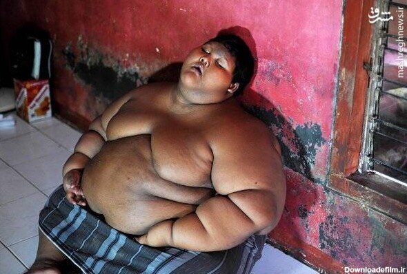 چاق‌ترین پسر جهان لاغر شد +تصاویر