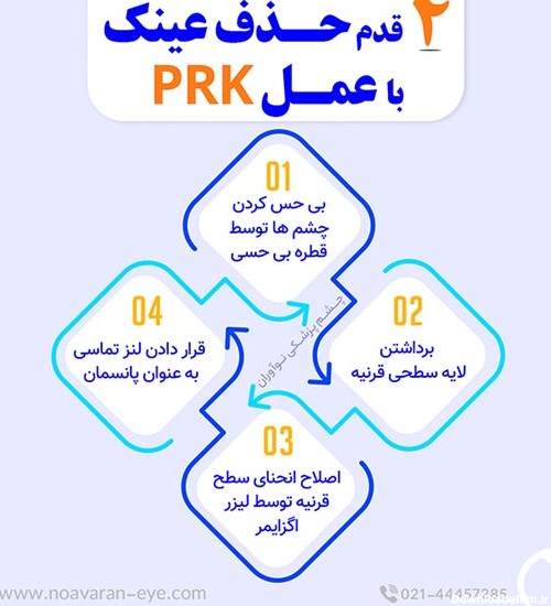 عمل پی آر کی (PRK) چیست؟ - چشم پزشکی نوآوران