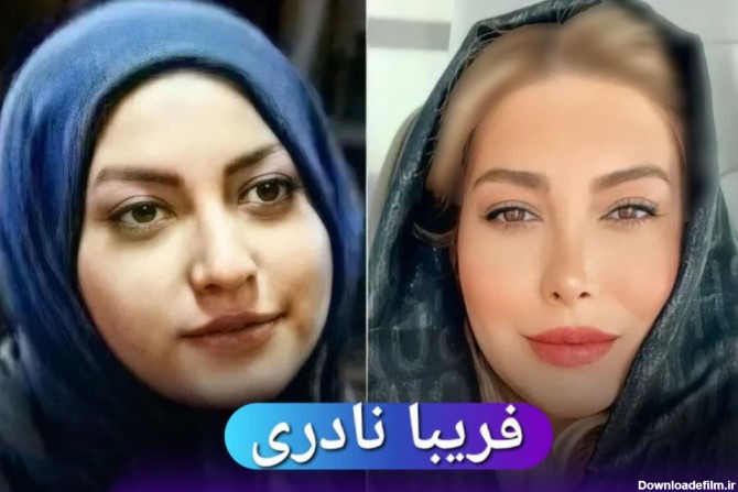این 8 خانم بازیگر ایرانی صورتشان را از نو ساختند ! / چی بودند و چی ...